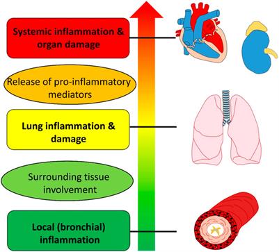 Editorial: Treatment of comorbidities of asthma and its safety